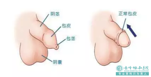 金华婺城区割包皮一般去哪家医院比较好